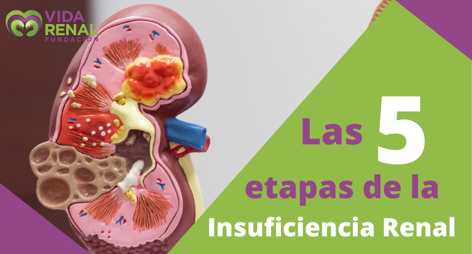 ¿cuáles Son Las 5 Etapas De La Insuficiencia Renal Vida Renalemk 7528